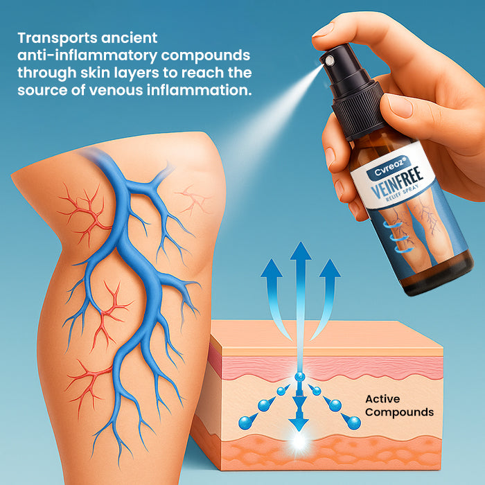 Cvreozยฎ VeinFree Relief Spray (๐๐% ๐๐ฝ๐ฝ ๐๐ก๐๐ฆ ๐๐ก ๐ญ๐ฌ ๐ ๐๐ก๐จ๐ง๐๐ฆ)