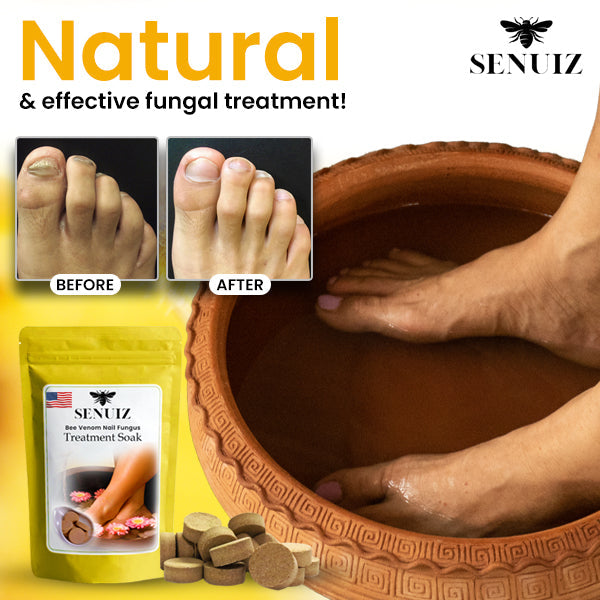 SENUIZ™ Bee Venom Nail Fungus Treatment Soak (10pcs) - (SALE ENDS IN 10 MINUTES)