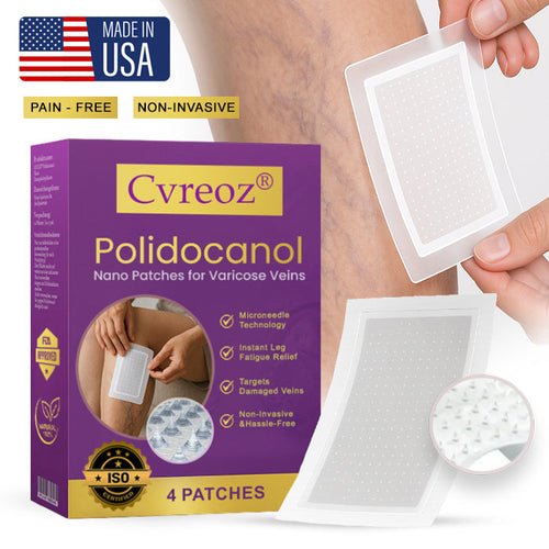 Cvreozยฎ Polidocanol Nano Patches for Varicose Veins (๐๐% ๐๐ฝ๐ฝ ๐๐ก๐๐ฆ ๐๐ก ๐ญ๐ฌ ๐ ๐๐ก๐จ๐ง๐๐ฆ)