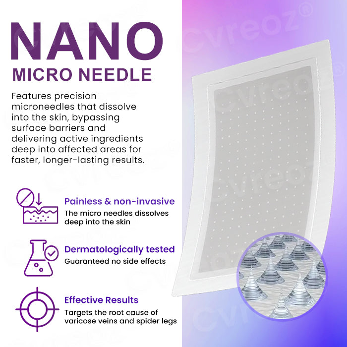 Cvreozยฎ Polidocanol Nano Patches for Varicose Veins (๐๐% ๐๐ฝ๐ฝ ๐๐ก๐๐ฆ ๐๐ก ๐ญ๐ฌ ๐ ๐๐ก๐จ๐ง๐๐ฆ)