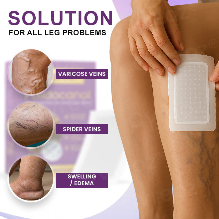 Cvreozยฎ Polidocanol Nano Patches for Varicose Veins (๐๐% ๐๐ฝ๐ฝ ๐๐ก๐๐ฆ ๐๐ก ๐ญ๐ฌ ๐ ๐๐ก๐จ๐ง๐๐ฆ)