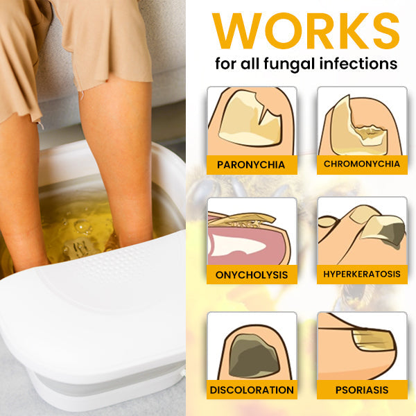 SENUIZ™ Bee Venom Nail Fungus Treatment Soak (10pcs) - (SALE ENDS IN 10 MINUTES)