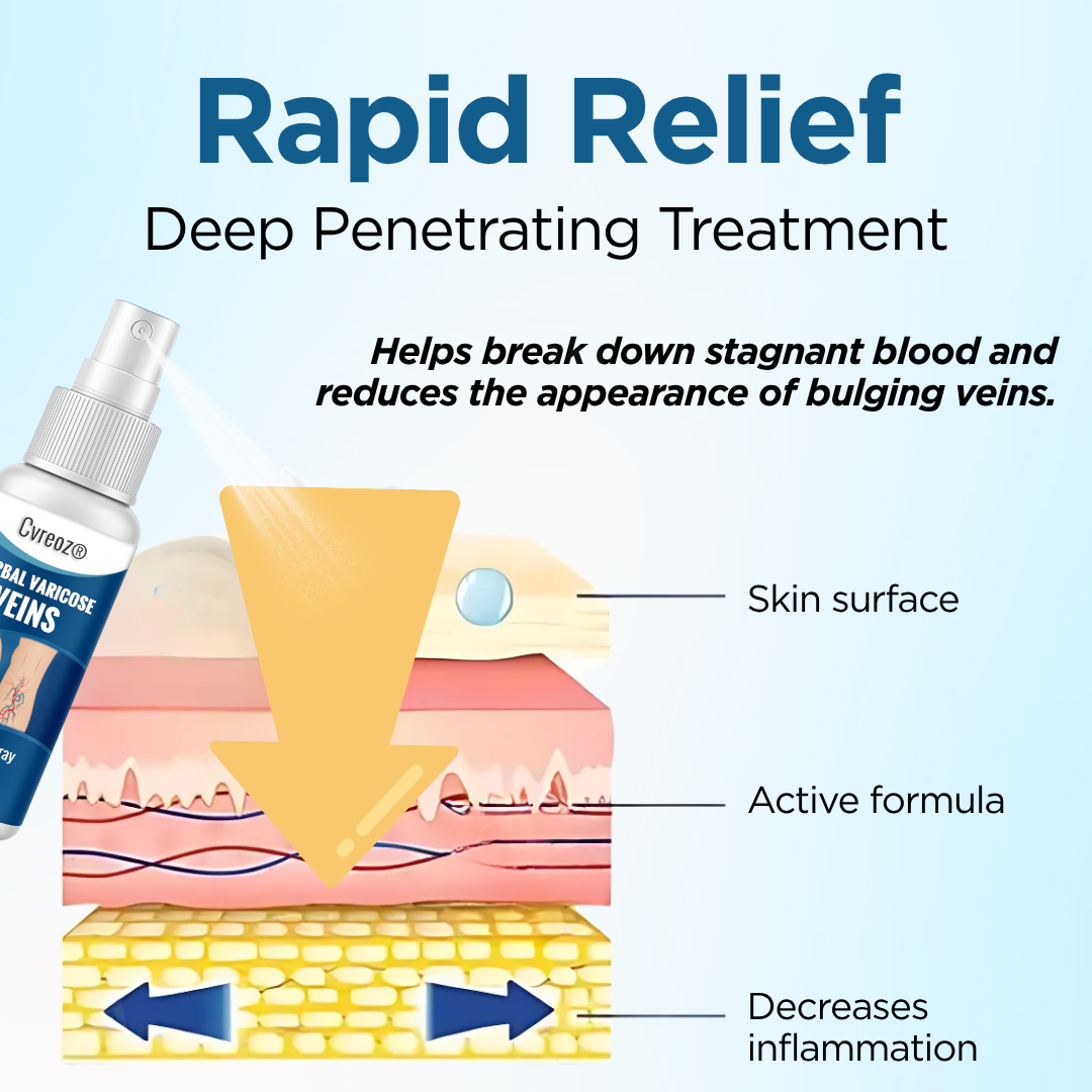 Cvreoz® Herbal Varicose Veins Treatment Spray (𝟟𝟘% 𝕆𝔽𝔽 𝗘𝗡𝗗𝗦 𝗜𝗡 𝟭𝟬 𝗠𝗜𝗡𝗨𝗧𝗘𝗦)