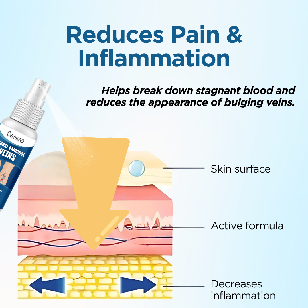 Cvreoz® Herbal Varicose Veins Treatment Spray (𝟟𝟘% 𝕆𝔽𝔽 𝗘𝗡𝗗𝗦 𝗜𝗡 𝟭𝟬 𝗠𝗜𝗡𝗨𝗧𝗘𝗦)