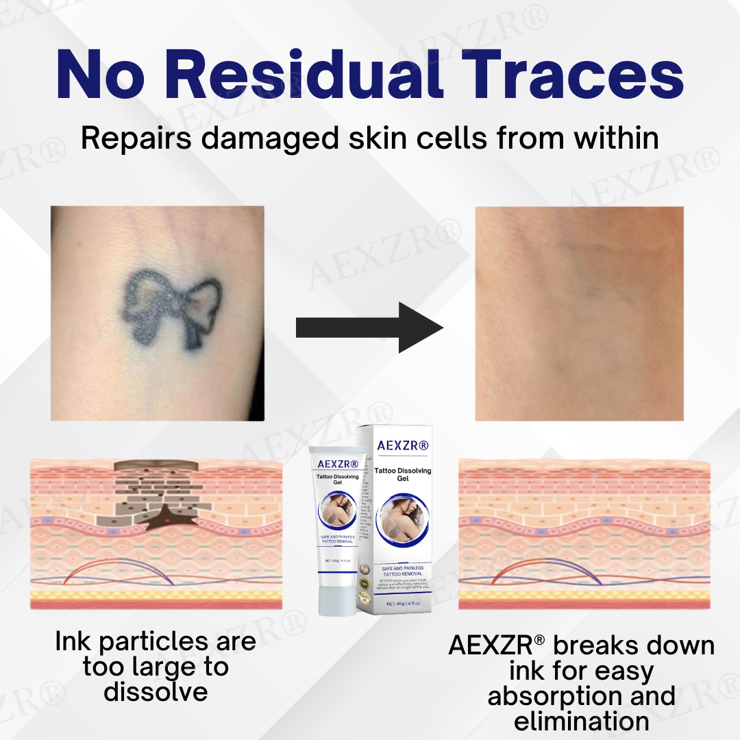 AEXZRยฎ Tattoo Dissolving Gel (๐๐% ๐๐ฝ๐ฝ ๐๐ก๐๐ฆ ๐๐ก ๐ญ๐ฌ ๐ ๐๐ก๐จ๐ง๐๐ฆ)