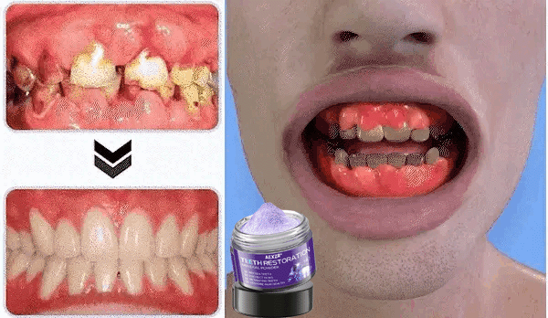 AEXZR® Teeth Restoration Mineral Powder (𝟟𝟘% 𝕆𝔽𝔽 𝗘𝗡𝗗𝗦 𝗜𝗡 𝟭𝟬 𝗠𝗜𝗡𝗨𝗧𝗘𝗦)