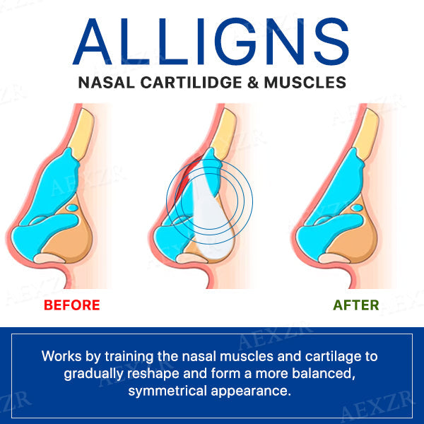 Nostafix™ Nose Corrector Device (SALE ENDS IN 10 MINUTES)