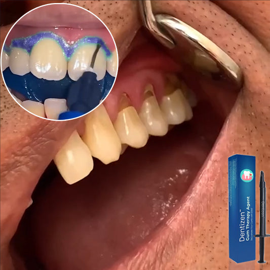 AEXZR® Gum Therapy Agent (𝟟𝟘% 𝕆𝔽𝔽 𝗘𝗡𝗗𝗦 𝗜𝗡 𝟭𝟬 𝗠𝗜𝗡𝗨𝗧𝗘𝗦)