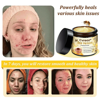 Cvreoz® Bee Venom Skin Treatment Cream