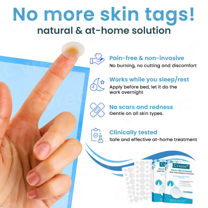 Cvreoz® Nano-Micro Needle Skin Tags Removal Patches (𝟟𝟘% 𝕆𝔽𝔽 𝗘𝗡𝗗𝗦 𝗜𝗡 𝟭𝟬 𝗠𝗜𝗡𝗨𝗧𝗘𝗦)