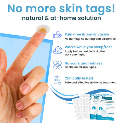 Cvreoz® Nano-Micro Needle Skin Tags Removal Patches (𝟟𝟘% 𝕆𝔽𝔽 𝗘𝗡𝗗𝗦 𝗜𝗡 𝟭𝟬 𝗠𝗜𝗡𝗨𝗧𝗘𝗦)