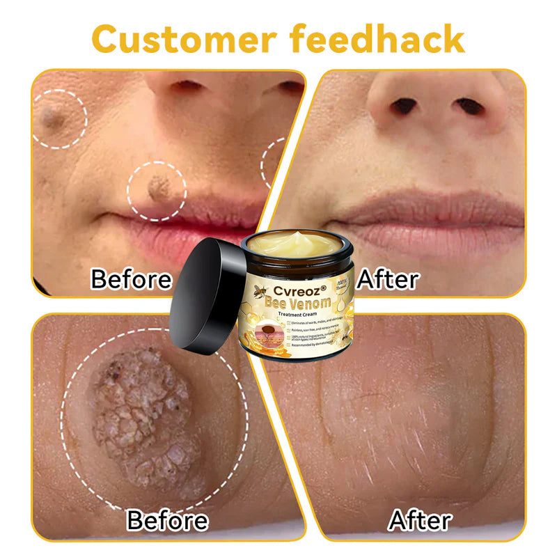 Cvreoz® Bee Venom Skin Treatment Cream