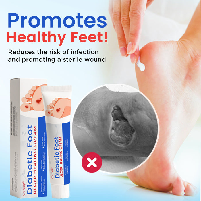 Cvreoz® Diabetic Foot Ulcer Healing Cream (𝟟𝟘% 𝕆𝔽𝔽 𝗘𝗡𝗗𝗦 𝗜𝗡 𝟭𝟬 𝗠𝗜𝗡𝗨𝗧𝗘𝗦)