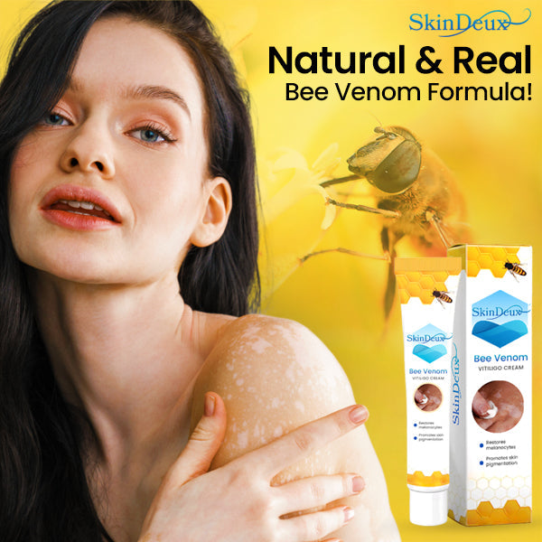 SkinDeux™ Bee Venom Vitiligo Cream (SALE ENDS IN 10 MINUTES)