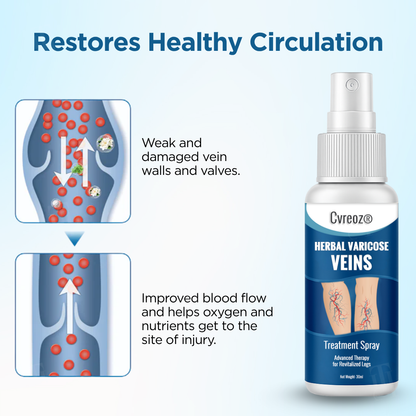 Cvreoz® Herbal Varicose Veins Treatment Spray (𝟟𝟘% 𝕆𝔽𝔽 𝗘𝗡𝗗𝗦 𝗜𝗡 𝟭𝟬 𝗠𝗜𝗡𝗨𝗧𝗘𝗦)