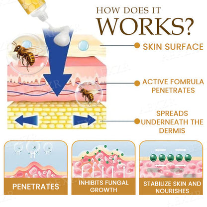 AEXZR® Bee Venom Genital Itch Relief Cream (𝟟𝟘% 𝕆𝔽𝔽 𝗘𝗡𝗗𝗦 𝗜𝗡 𝟭𝟬 𝗠𝗜𝗡𝗨𝗧𝗘𝗦)