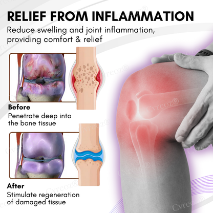 Cvreoz® Turmeric & Emu Oil Arthritis Soothing Pain Relief Massage Gel (𝟟𝟘% 𝕆𝔽𝔽 𝗘𝗡𝗗𝗦 𝗜𝗡 𝟭𝟬 𝗠𝗜𝗡𝗨𝗧𝗘𝗦)