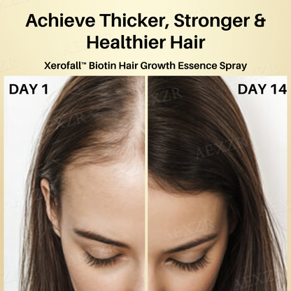 Xerofall™ Biotin Hair Growth Essence Spray (SALE ENDS IN 10 MINUTES)