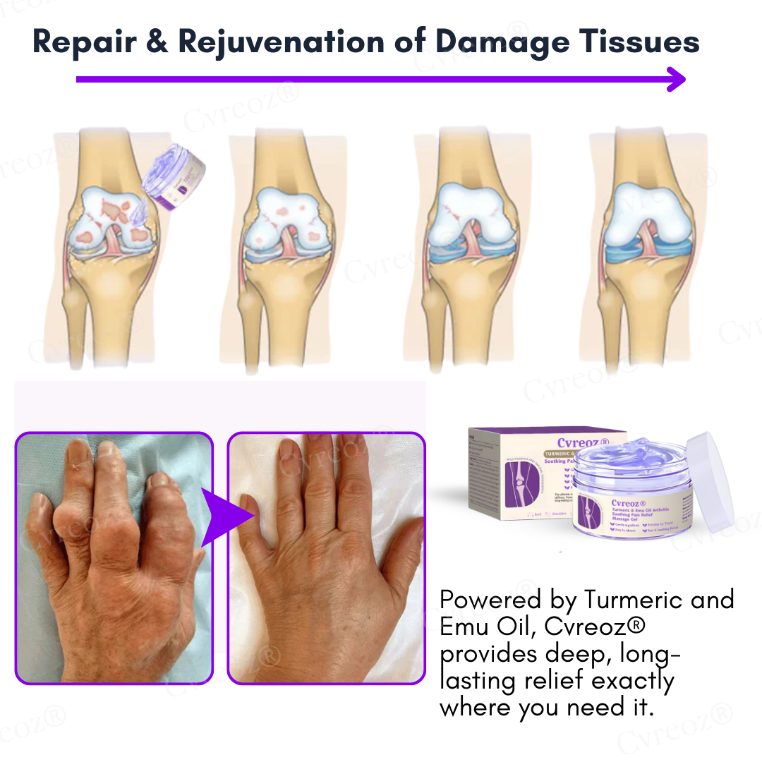 Cvreoz® Turmeric & Emu Oil Arthritis Soothing Pain Relief Massage Gel (𝟟𝟘% 𝕆𝔽𝔽 𝗘𝗡𝗗𝗦 𝗜𝗡 𝟭𝟬 𝗠𝗜𝗡𝗨𝗧𝗘𝗦)