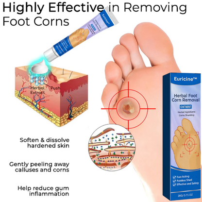 Euricine™ Herbal Foot Corn Removal Ointment