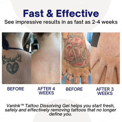 VanInk™ Tattoo Dissolving Gel (SALE ENDS IN 10 MINUTES)