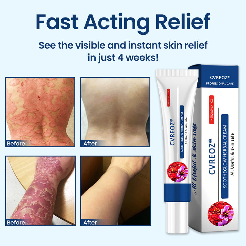 Cvreoz®  SootheGlow Herbal Cream