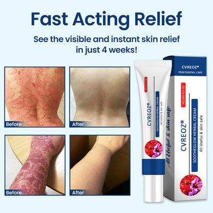Cvreoz®  SootheGlow Herbal Cream