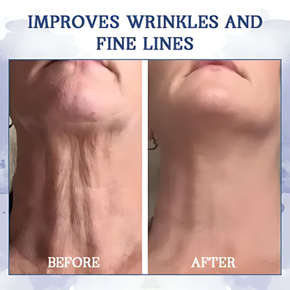 AEXZR® Advanced Firming & Wrinkle-Reducing Cream (SALE ENDS IN 10 MINUTES)