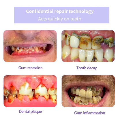 AEXZR™ Teeth Restoration Mineral Powder (𝟟𝟘% 𝕆𝔽𝔽 𝗘𝗡𝗗𝗦 𝗜𝗡 𝟭𝟬 𝗠𝗜𝗡𝗨𝗧𝗘𝗦)