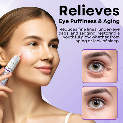 AEXZR™ Eye Puffiness Remover Cream