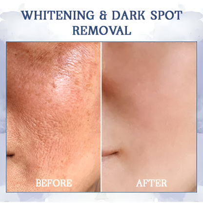 AEXZR® Advanced Firming & Wrinkle-Reducing Cream (SALE ENDS IN 10 MINUTES)