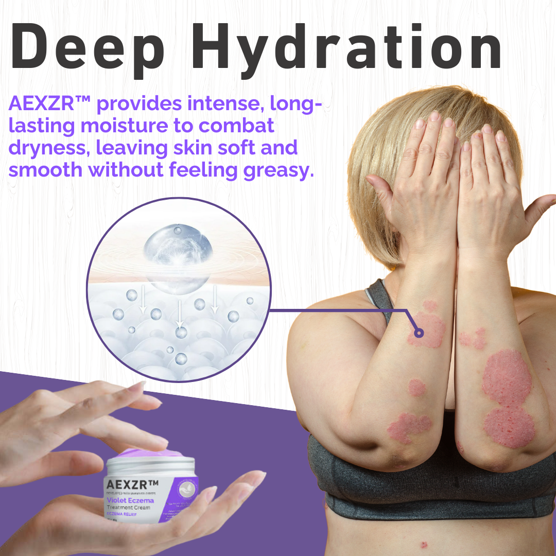 AEXZR™ Violet Eczema Treatment Cream