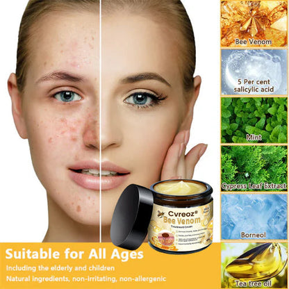 Cvreoz® Bee Venom Skin Treatment Cream