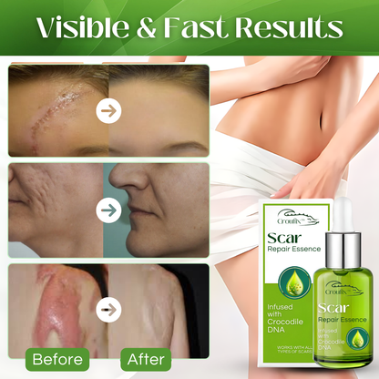 Croufix™ Scar Repair Essence (SALE ENDS IN 10 MINUTES)