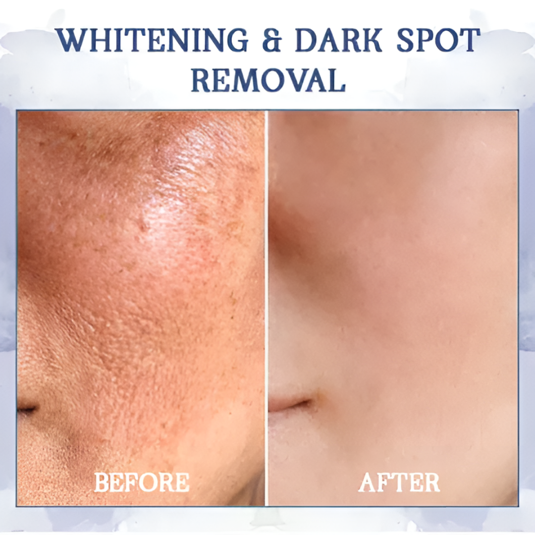 AEXZR® Advanced Firming & Wrinkle-Reducing Cream