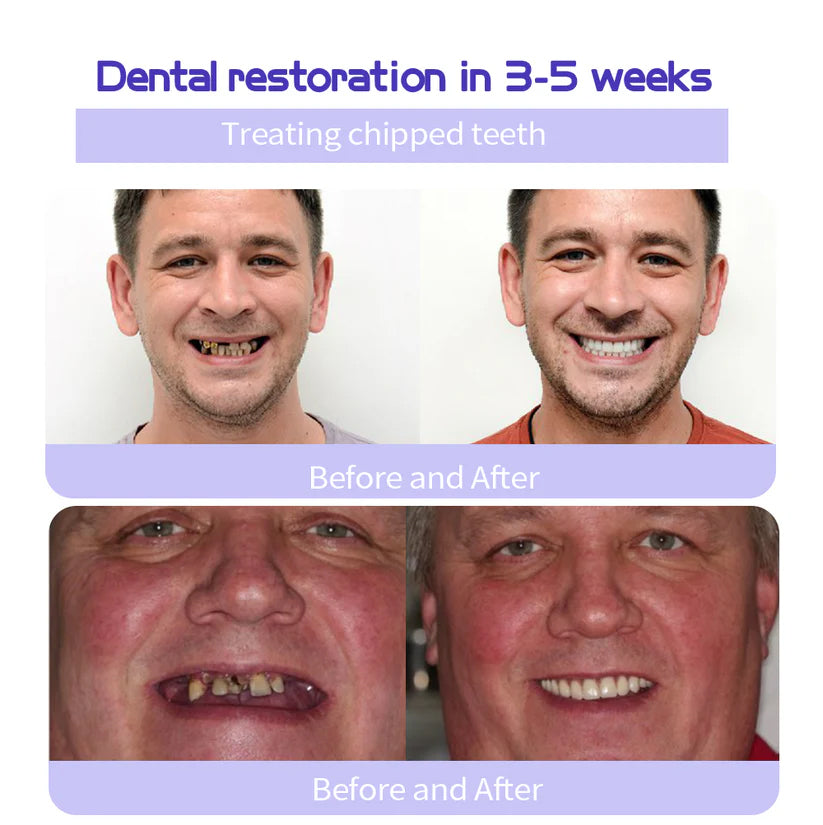 AEXZR™ Teeth Restoration Mineral Powder (𝟟𝟘% 𝕆𝔽𝔽 𝗘𝗡𝗗𝗦 𝗜𝗡 𝟭𝟬 𝗠𝗜𝗡𝗨𝗧𝗘𝗦)