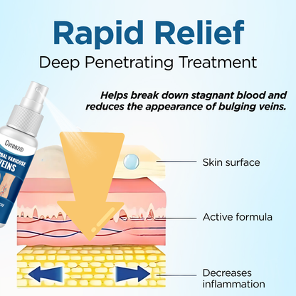 Cvreoz® Herbal Varicose Veins Treatment Spray (𝟟𝟘% 𝕆𝔽𝔽 𝗘𝗡𝗗𝗦 𝗜𝗡 𝟭𝟬 𝗠𝗜𝗡𝗨𝗧𝗘𝗦)