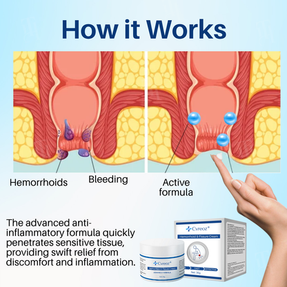 LAST 44 PCS LEFT!! Cvreoz® Hemorrhoid & Fissure Cream