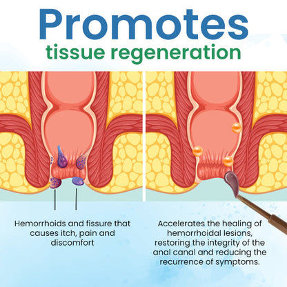 Quezy™ Hemorrhoids Treatment Gel