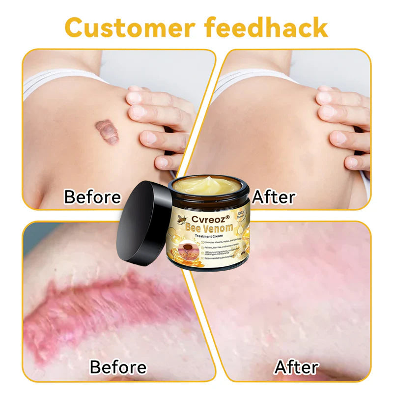 Cvreoz® Bee Venom Skin Treatment Cream