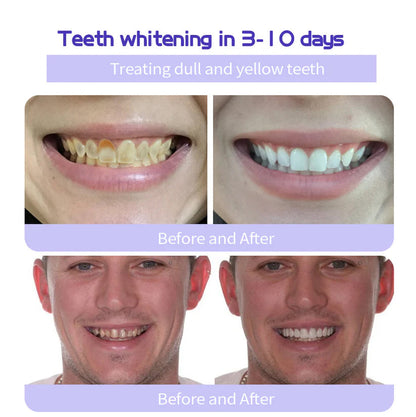 AEXZR™ Teeth Restoration Mineral Powder (𝟟𝟘% 𝕆𝔽𝔽 𝗘𝗡𝗗𝗦 𝗜𝗡 𝟭𝟬 𝗠𝗜𝗡𝗨𝗧𝗘𝗦)