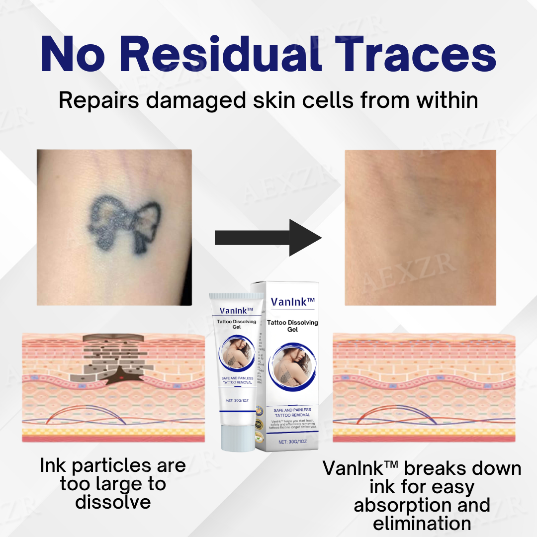 VanInk™ Tattoo Dissolving Gel (SALE ENDS IN 10 MINUTES)