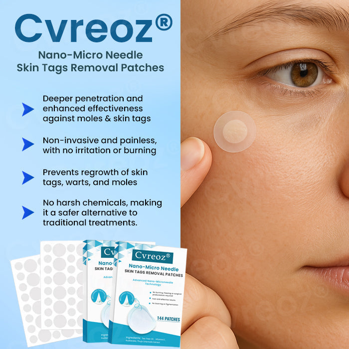 Cvreoz® Nano-Micro Needle Skin Tags Removal Patches (𝟟𝟘% 𝕆𝔽𝔽 𝗘𝗡𝗗𝗦 𝗜𝗡 𝟭𝟬 𝗠𝗜𝗡𝗨𝗧𝗘𝗦)