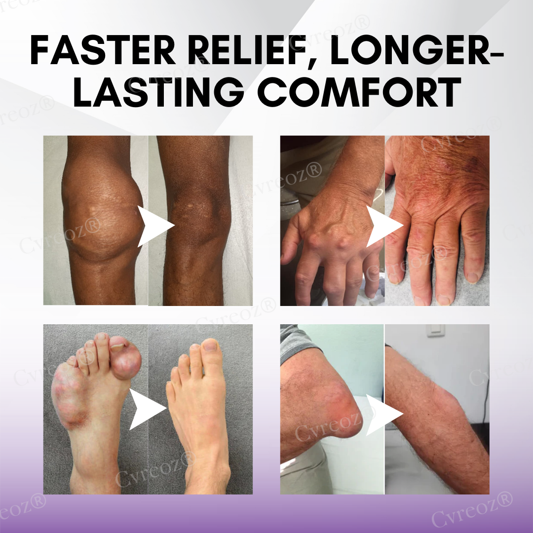 Cvreoz® Turmeric & Emu Oil Arthritis Soothing Pain Relief Massage Gel (𝟟𝟘% 𝕆𝔽𝔽 𝗘𝗡𝗗𝗦 𝗜𝗡 𝟭𝟬 𝗠𝗜𝗡𝗨𝗧𝗘𝗦)