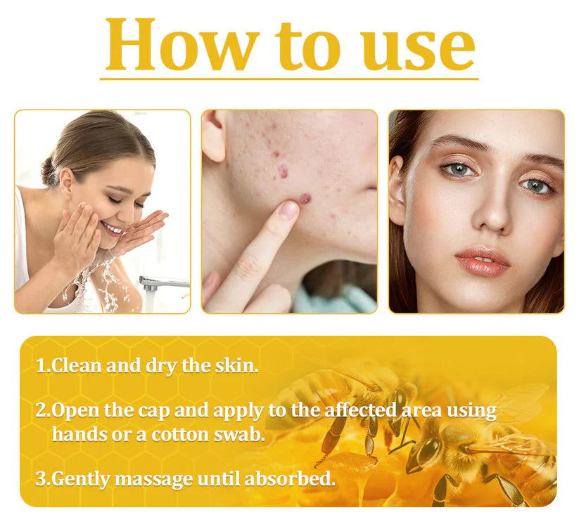 Cvreoz® Bee Venom Skin Treatment Cream