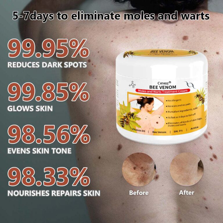 Cvreoz® PRO Bee Venom Mole and Wart Treatment Cream