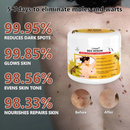 Cvreoz® PRO Bee Venom Mole and Wart Treatment Cream