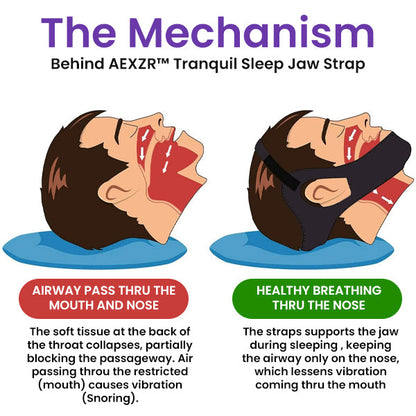 AEXZR™ Tranquil Sleep Jaw Strap